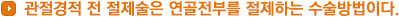 관절경적 전 절제술은 연골전부를 절제하는 수술방법이다.